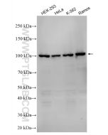 MCM10 Polyclonal antibody 12251-1-AP proteintech