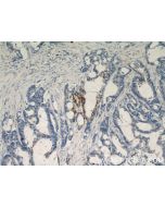 RHOF Polyclonal antibody 12290-1-AP proteintech
