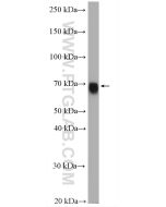 GATAD2A Polyclonal antibody 12294-1-AP proteintech