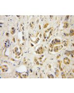 TBCA Polyclonal antibody 12304-1-AP proteintech