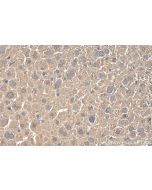 MAT1A/MAT2A Polyclonal antibody 12395-1-AP proteintech