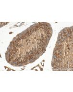 ACRBP Polyclonal antibody 12487-1-AP proteintech