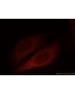 GAGE2D Polyclonal antibody 12532-1-AP proteintech