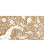 P4HA1 Polyclonal antibody 12658-1-AP proteintech