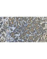 Protrudin Polyclonal antibody 12680-1-AP proteintech