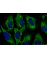 BMPR1A Polyclonal antibody 12702-1-AP proteintech