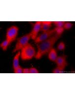 TROVE2 Polyclonal antibody 12718-1-AP proteintech