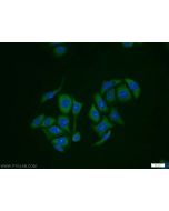 RabGEF1 Polyclonal antibody 12735-1-AP proteintech