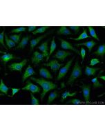 Collagen Type XXV Polyclonal antibody 12738-1-AP proteintech