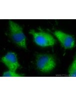 MACF1 Polyclonal antibody 13058-1-AP proteintech