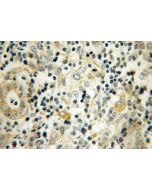 UBTD2 Polyclonal antibody 13172-1-AP proteintech