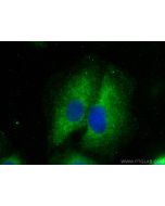 SAA Polyclonal antibody 13192-1-AP proteintech