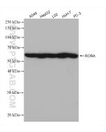 RORA Recombinant monoclonal antibody Proteintech  82930-1-RR