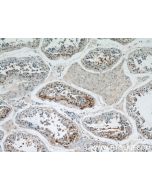SPPL2A Polyclonal antibody 13255-1-AP proteintech
