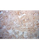 DLX3 Polyclonal antibody 13261-3-AP proteintech