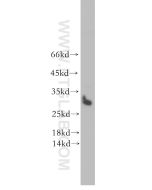 STOML3 Polyclonal antibody 13316-1-AP proteintech