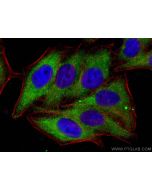 Zinc Alpha 2 Glycoprotein Polyclonal antibody 13399-1-AP proteintech