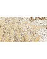 PPP3CA Polyclonal antibody 13422-1-AP proteintech