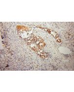 KHDRBS3 Polyclonal antibody 13563-1-AP proteintech