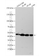 ST3GAL2 Polyclonal antibody 13620-1-AP proteintech