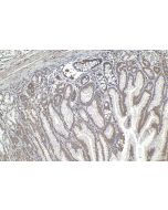 TRIM15 Polyclonal antibody 13623-1-AP proteintech