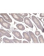 TROAP Polyclonal antibody 13634-1-AP proteintech