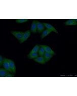 GART Polyclonal antibody 13659-1-AP proteintech