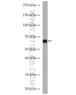 CDC14A Polyclonal antibody 13660-1-AP proteintech