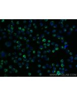 TRIM17 Polyclonal antibody 13663-1-AP proteintech