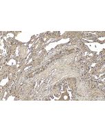 SFTPB Polyclonal antibody 13664-1-AP proteintech