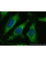 TRAK2 Polyclonal antibody 13770-1-AP proteintech