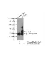 BTBD6 Polyclonal antibody 13776-1-AP proteintech