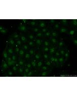 EAF1 Polyclonal antibody 13787-1-AP proteintech