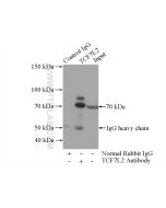 TCF4/TCF7L2 Polyclonal antibody 13838-1-AP proteintech
