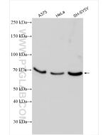 MCOLN3 Polyclonal antibody 13879-1-AP proteintech