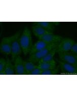 FBXL14 Polyclonal antibody 13934-1-AP proteintech