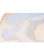SCNN1G Polyclonal antibody 13943-1-AP proteintech