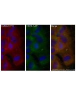 MKS3 Polyclonal antibody 13975-1-AP proteintech