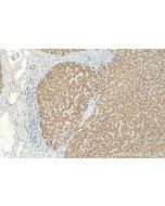NEDD1 Polyclonal antibody 13993-1-AP proteintech
