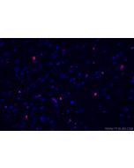 OLIG2 Polyclonal antibody 13999-1-AP proteintech