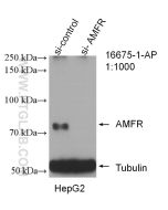 AMFR/GP78 Polyclonal antibody Proteintech  16675-1-AP