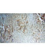 IGSF11 Polyclonal antibody 14003-1-AP proteintech