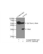 SOCS3 Polyclonal antibody 14025-1-AP proteintech