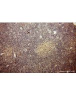 ROD1 Polyclonal antibody 14027-1-AP proteintech