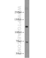 SMC5 Polyclonal antibody 14178-1-AP proteintech