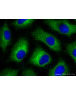 STAU1 Polyclonal antibody 14225-1-AP proteintech