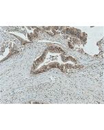 SLC39A6/ZIP6 Polyclonal antibody 14236-1-AP proteintech