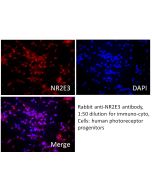 NR2E3 Polyclonal antibody 14246-1-AP proteintech