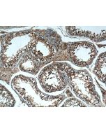 MSRB3 Polyclonal antibody 14251-1-AP proteintech