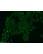 FN3K Polyclonal antibody 14293-1-AP proteintech